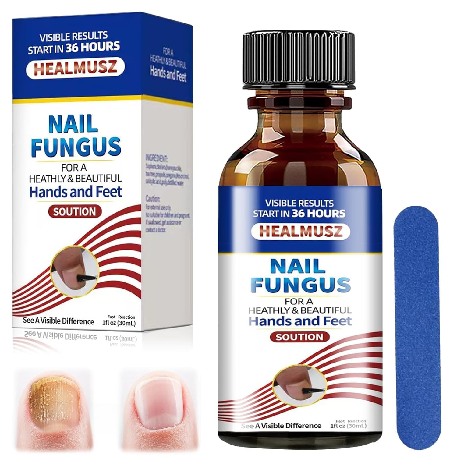 YOLONCE 30 ml Nail Care Treatment, Protection & Strengthening Brittle Nails, Nail Repair, Fingernails and Toenails for Nail Care, Toenail Treatment with Nail File, Discolored Finger Nails, Repairs Brittle