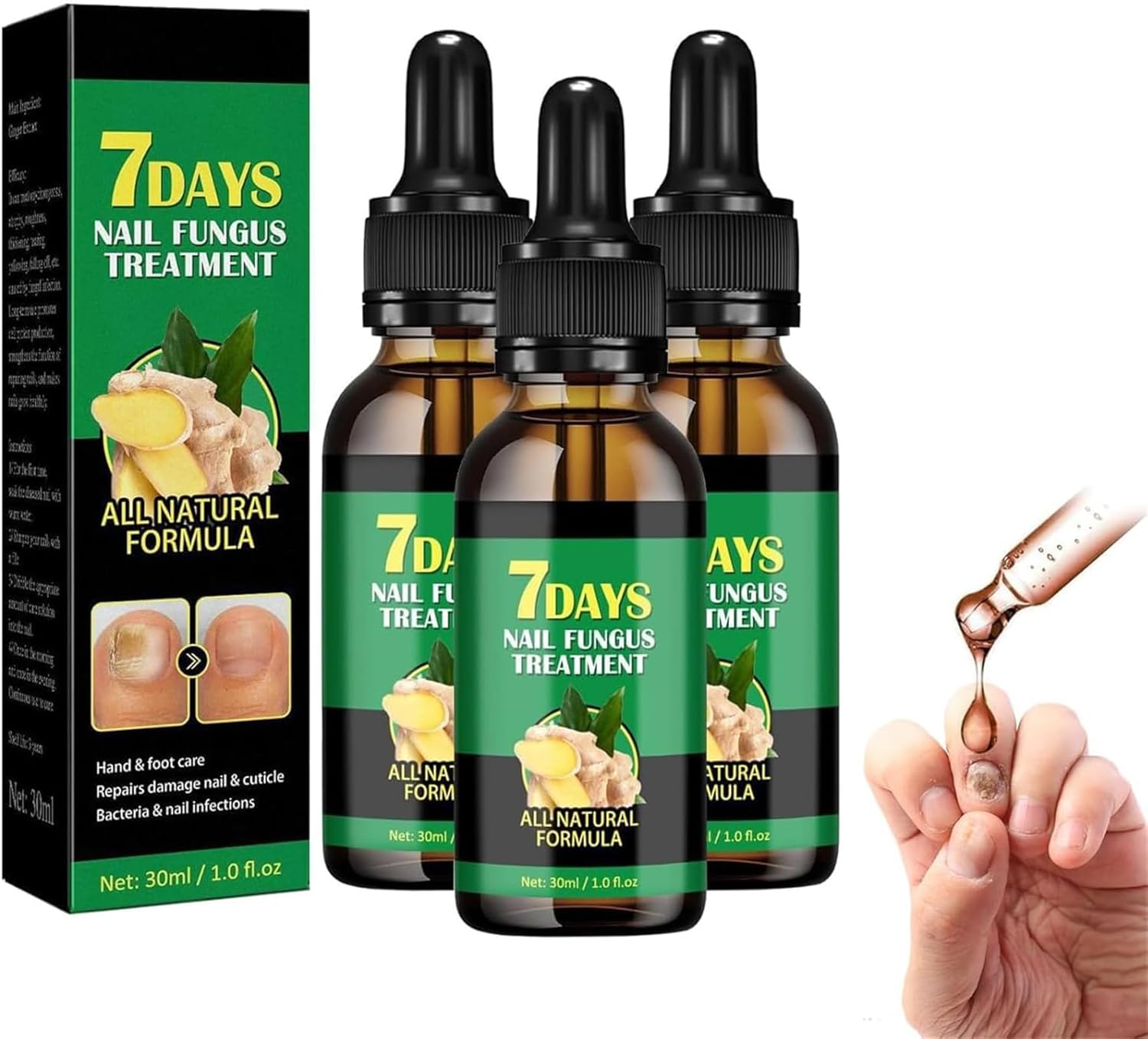 ERISAMO Ginger Nail Treatment Nail Support Nail Care, 7 Days Nail Treatment, Ginger Nail Growth Serum, Ginger Cuticle Care Oil for Nails, Nail Strengthener for Damaged Nails, Nourishing Moisturizing (3