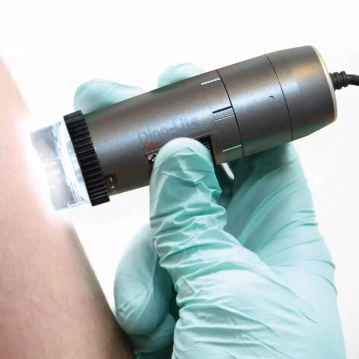 Dino-Lite DermaScope Polarizer HR 200x video dermatoscope