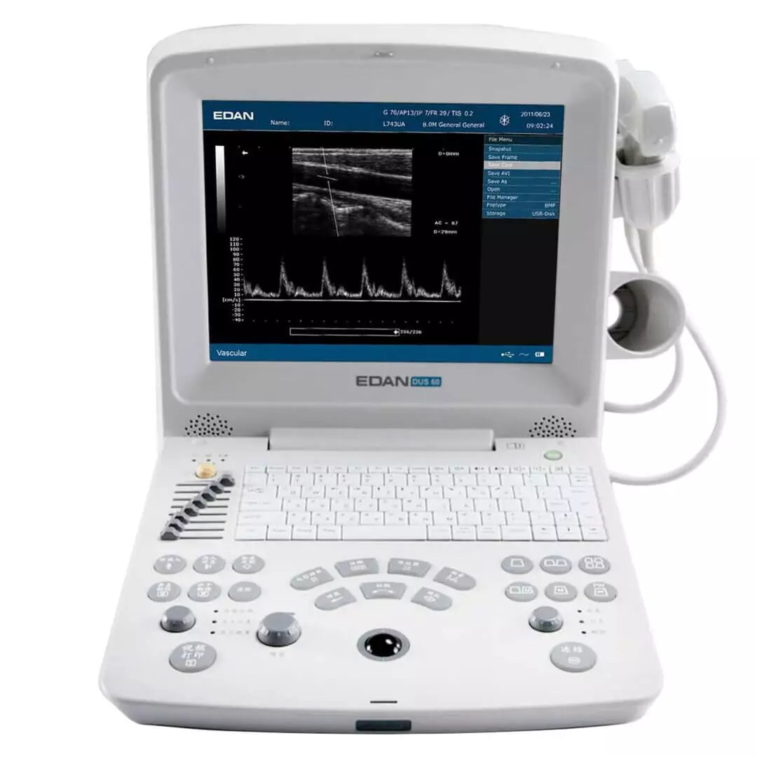 EDAN DUS 60 ultrasound scanner Linear and convex L 33 x W 22 x H 32 cm