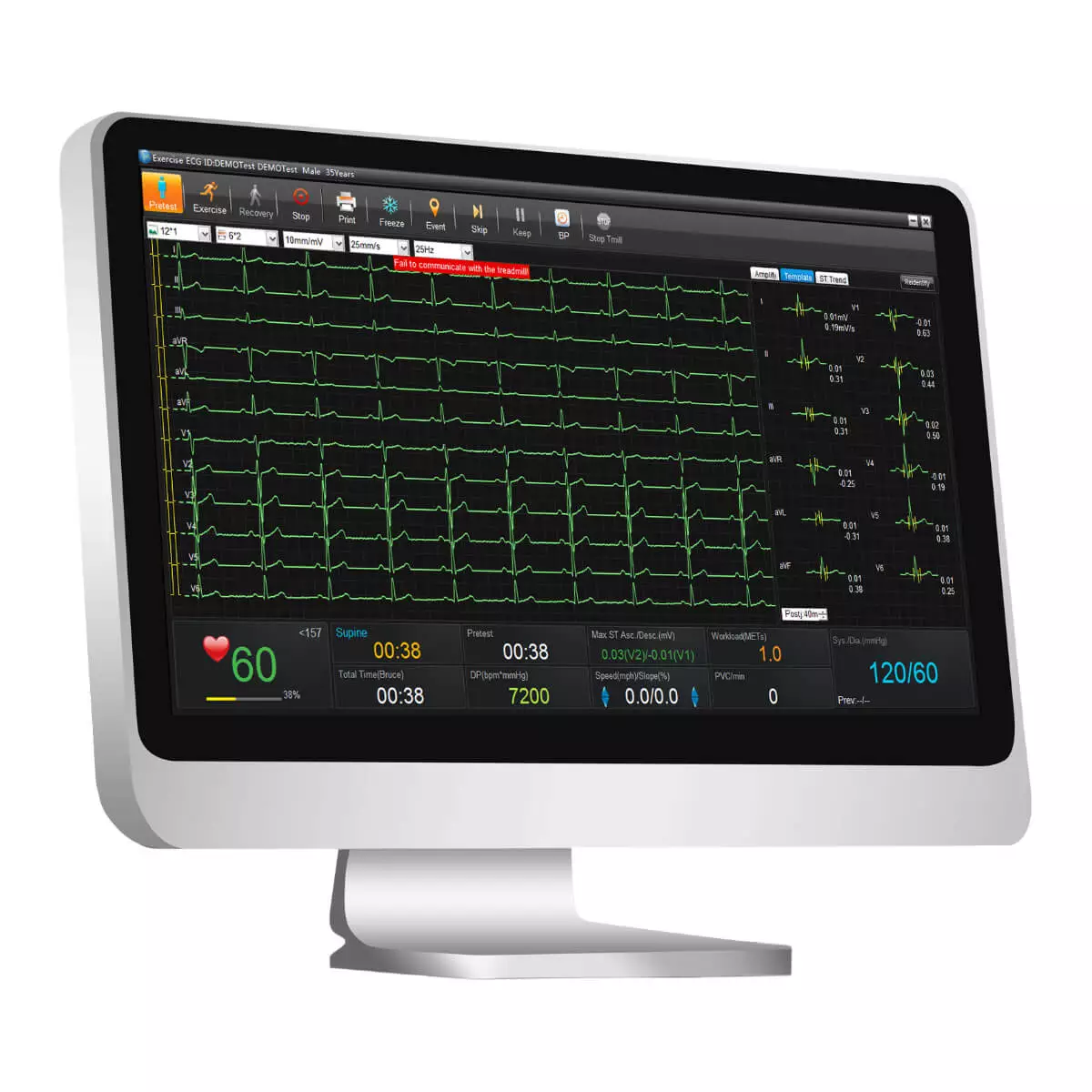EDAN SE-1515 ECG data management software without DX2 sampling box