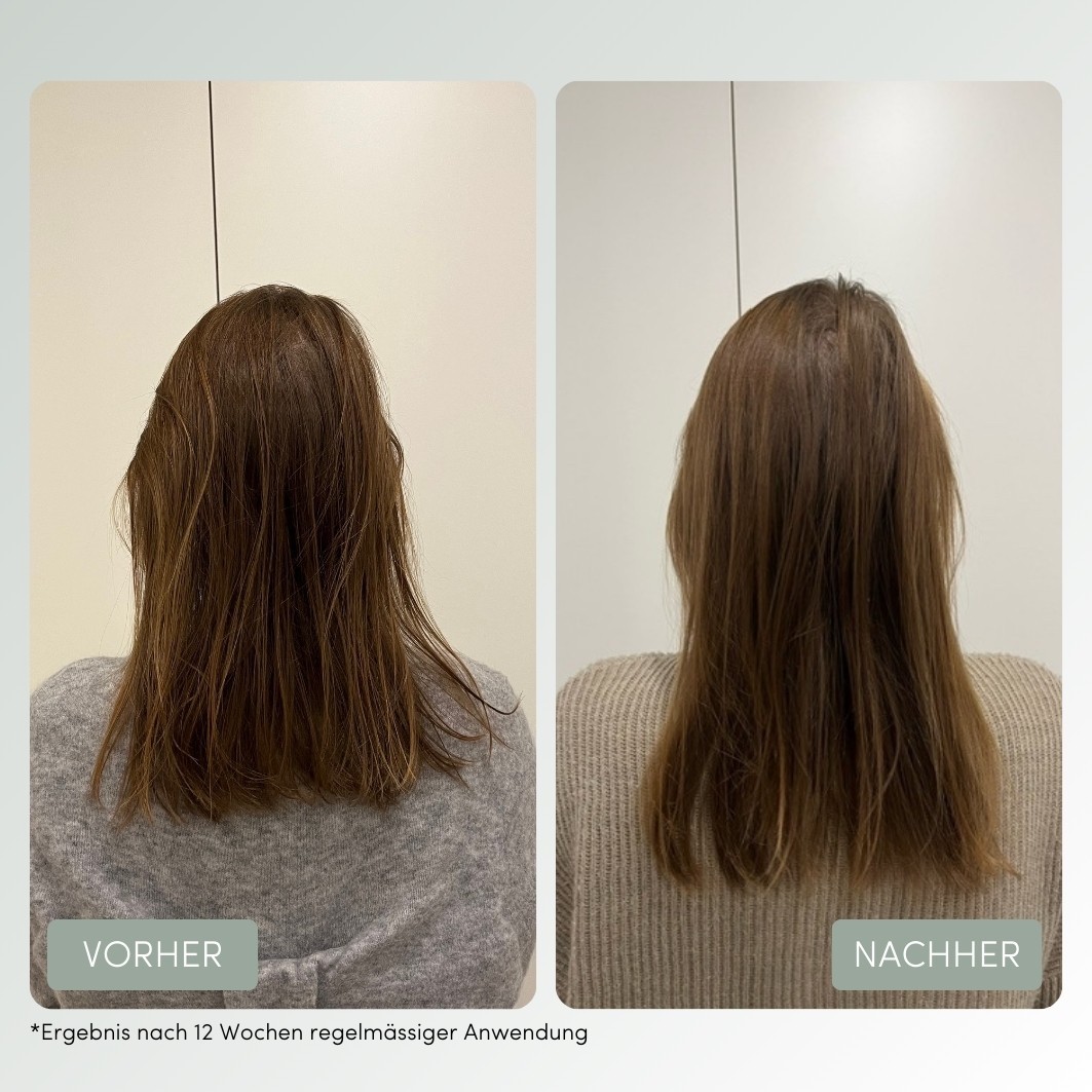 feschi hair tonic grow strong - follicusan tonic