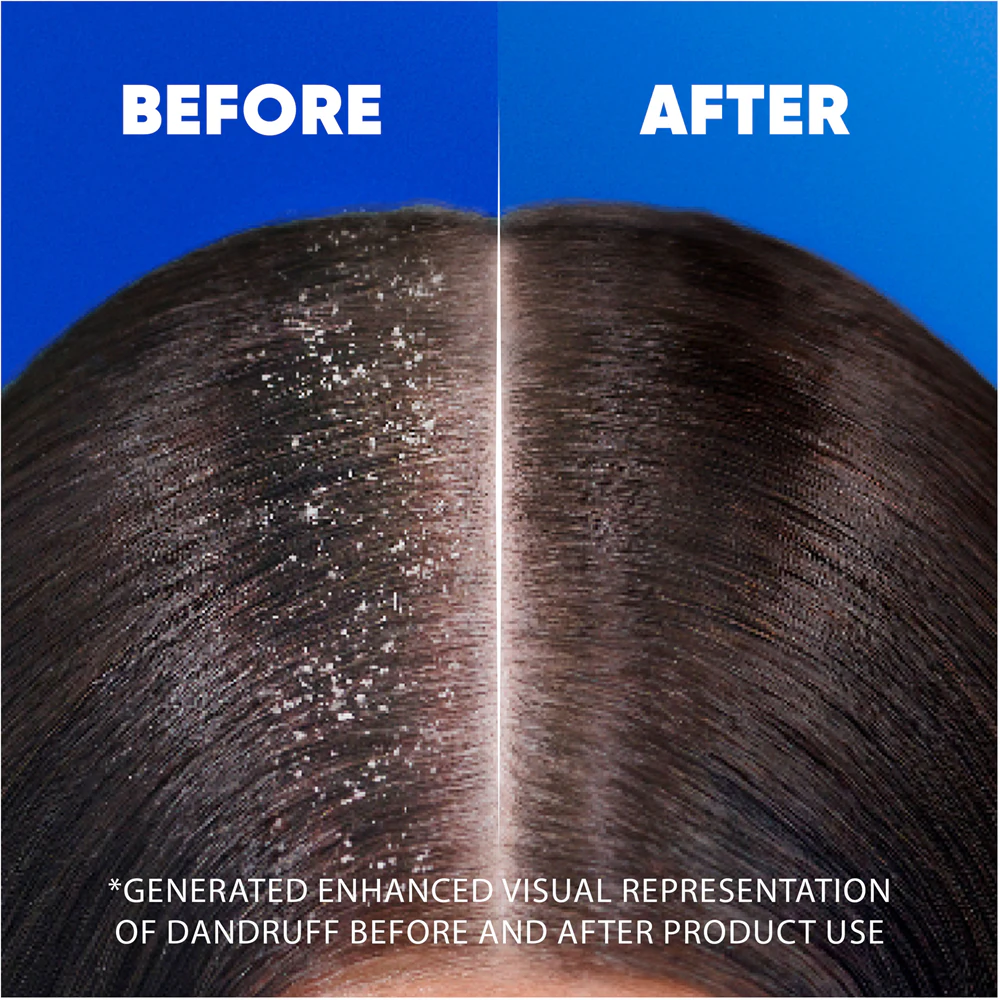 head&shoulders Head & Shoulders Menthol Fresh 2in1 Shampoo and Conditioner 2 in 1 against dandruff