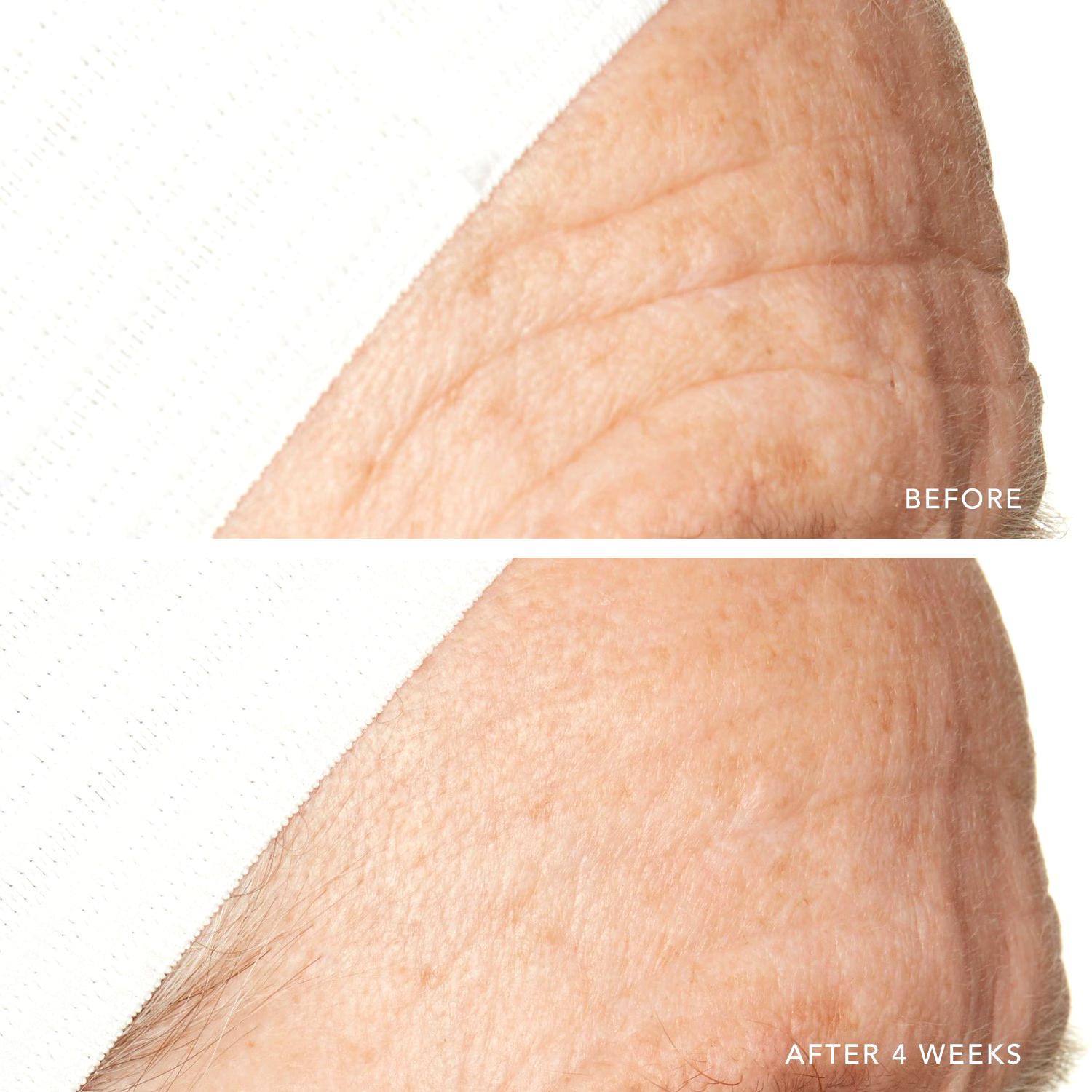 Lancer Anti-Aging Serum Active Rejuvenation Serum