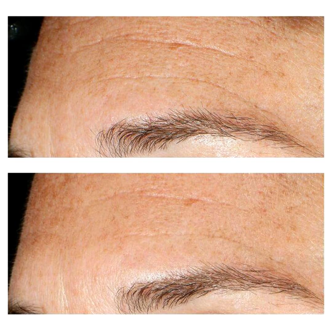 MURAD facial peeling Resurgence Replenishing Multi-Acid Peel