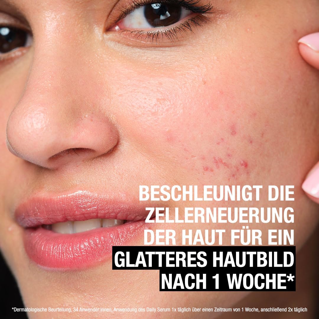 Neutrogena Anti-Pimple + Liquid Exfoliant Liquid Exfoliant with 7% AHA + Panthenol (125 ml) Gently Removes Dead Skin Cells & Excess Sebum (Pack of 2)