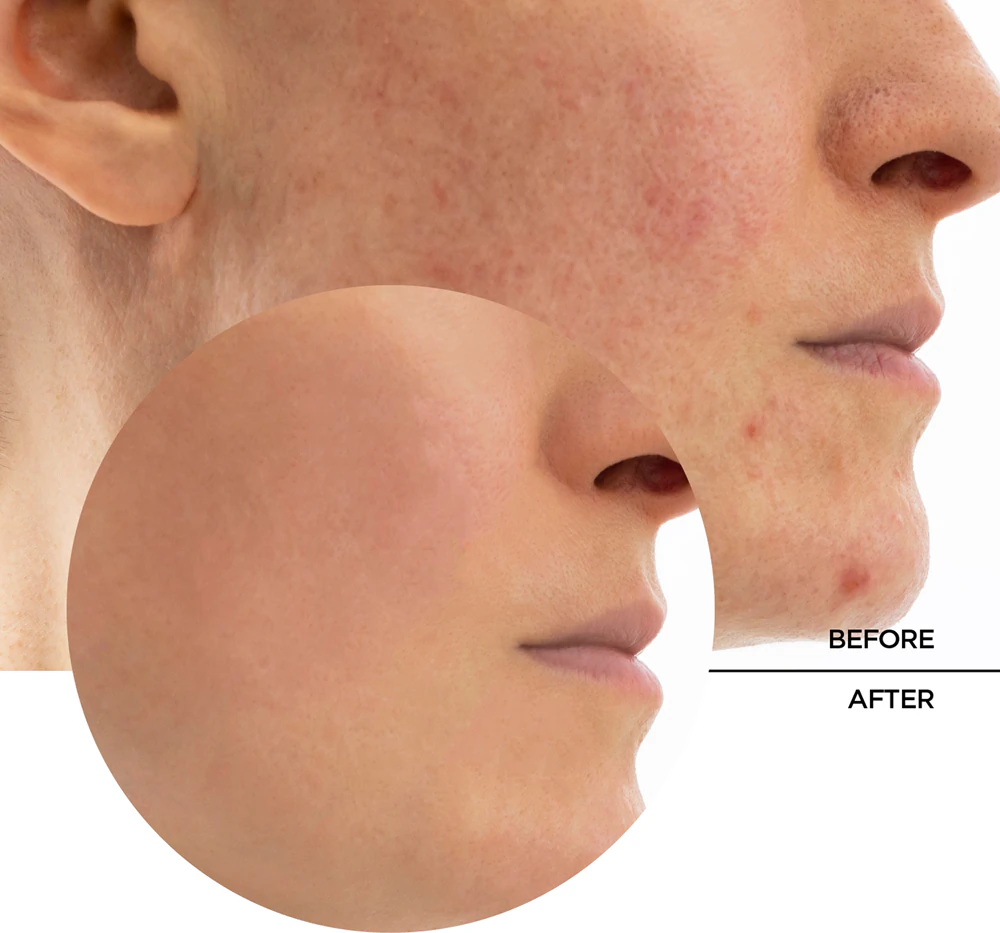 Revox B77 Skintreats Biotic Rebalancing Smoothing Gel Light gel cream to smooth and mattify the skin