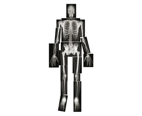 X-ray images of humans