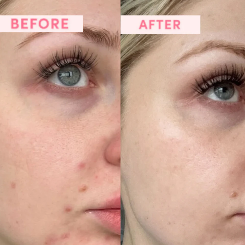 Sand & Sky Australian Emu Apple Resurfacing Mask smoothing mask to renew the skin's surface