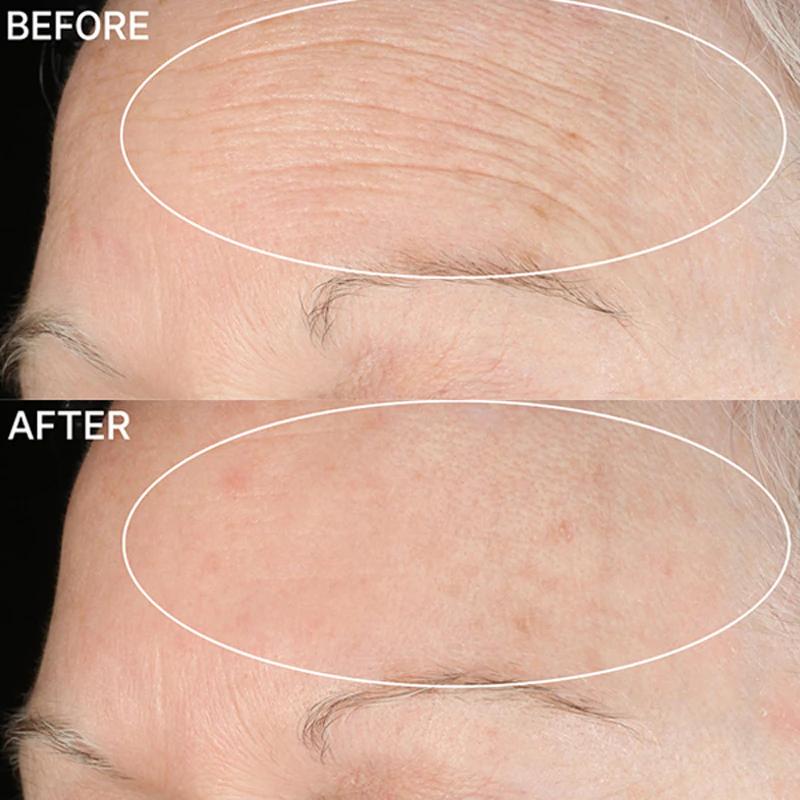 StriVectin Anti-Wrinkle SD Advanced Plus concentrated wrinkle reduction cream