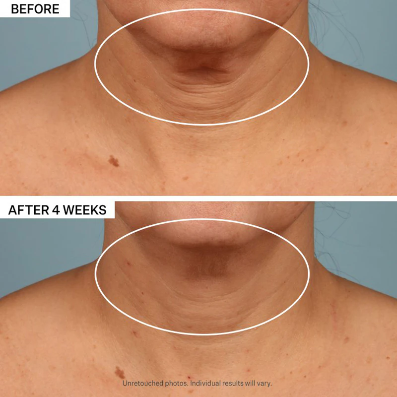 StriVectin Tighten & Lift TL Advanced Tightening Neck Cream Plus firming lifting cream for the neck and décolleté