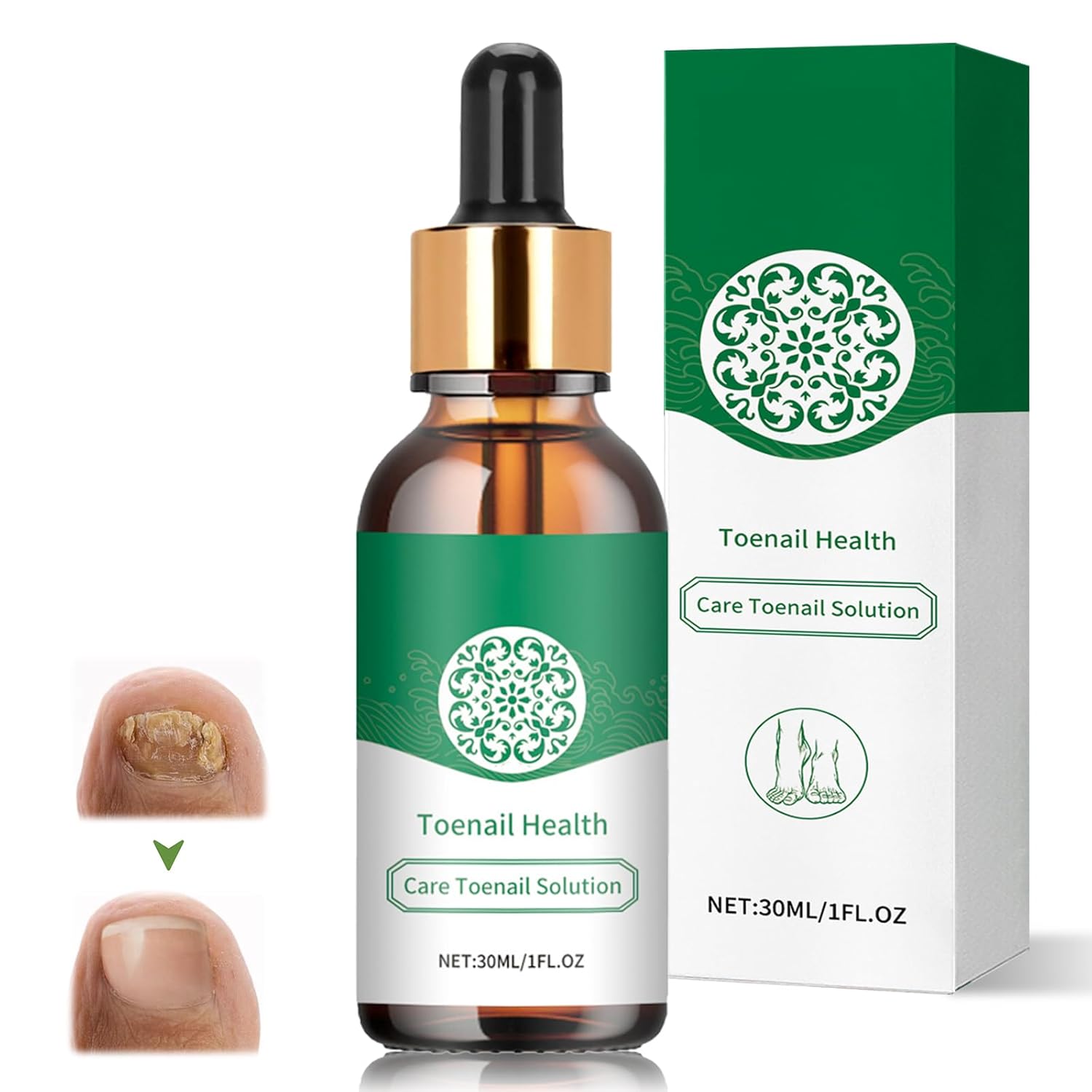 Yagaspantery Nail Care Treatment, 30 ml Brittle Nails Nail Repair, Nail Care, Toenail Treatment for Hard Thick Toenails