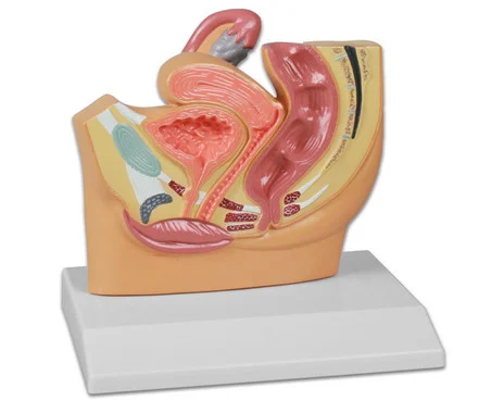 Female pelvic surgery
